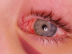 Trauma - Eyelid, Tear Duct & Face before